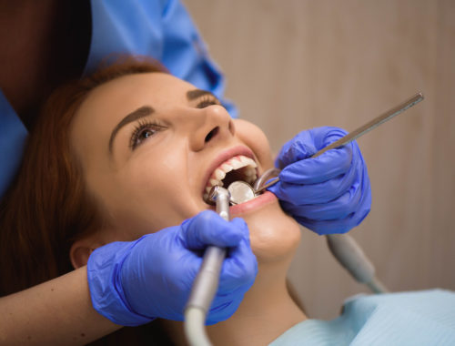 Eliminar manchas negras en los dientes